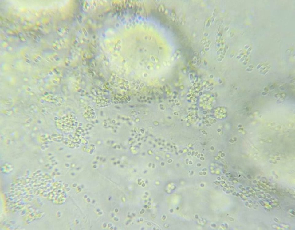 EHP spore extrusion