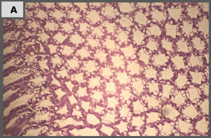 histo hepatopancreas