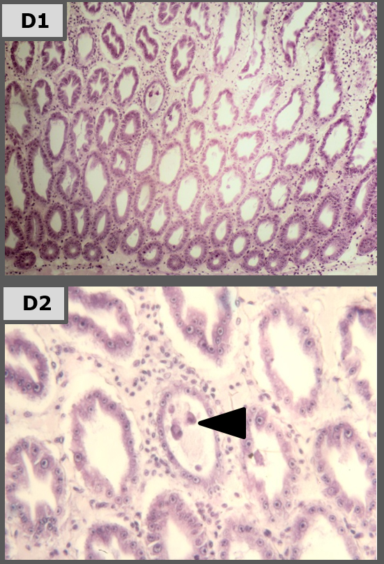 biểu mô hepatopancreas