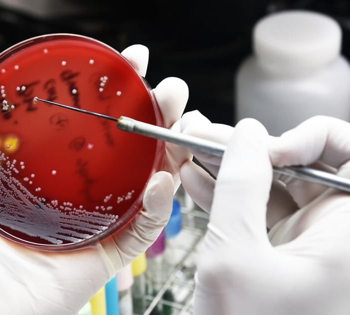 antibiotic-bacteria-cell-culture.jpeg